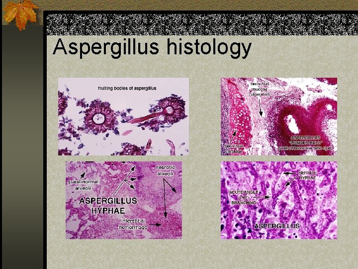 Aspergillus histology 