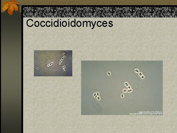 Coccidioidomyces 