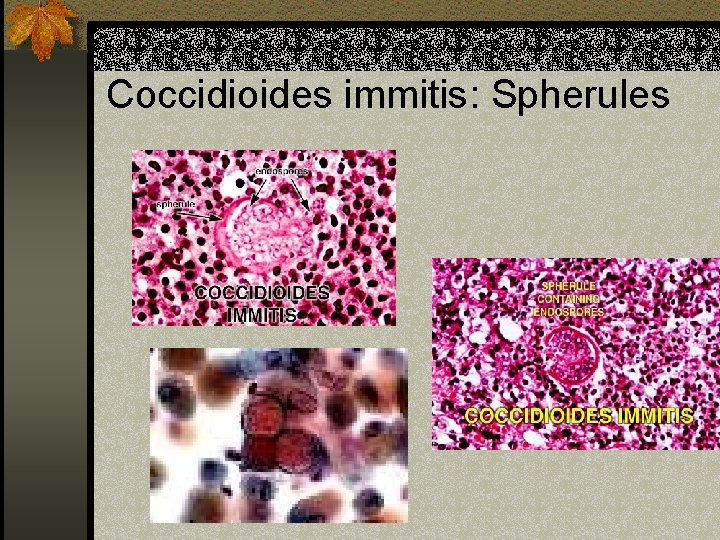 Coccidioides immitis: Spherules 