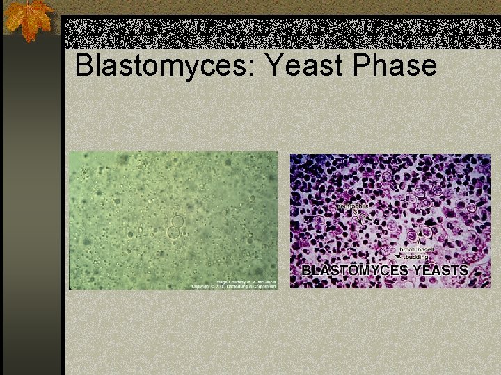 Blastomyces: Yeast Phase 