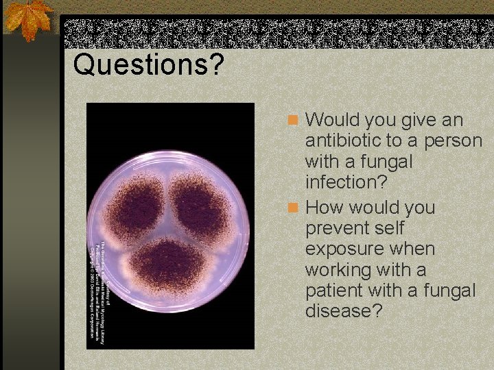 Questions? n Would you give an antibiotic to a person with a fungal infection?