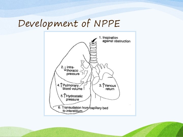 Development of NPPE 