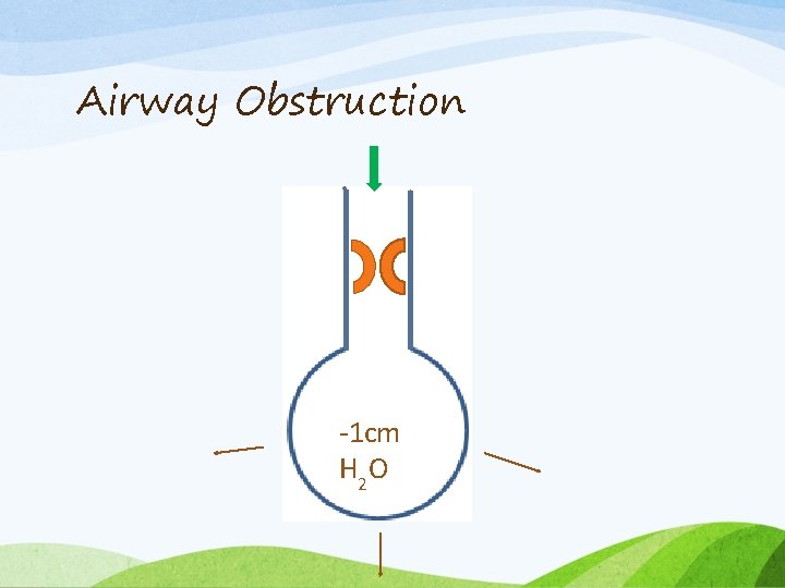 Airway Obstruction -1 cm H 2 O 