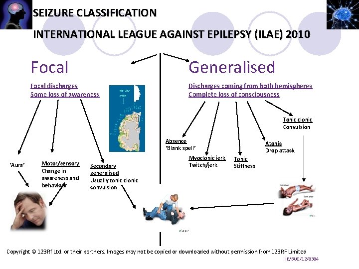 SEIZURE CLASSIFICATION INTERNATIONAL LEAGUE AGAINST EPILEPSY (ILAE) 2010 Focal Generalised Focal discharges Some loss