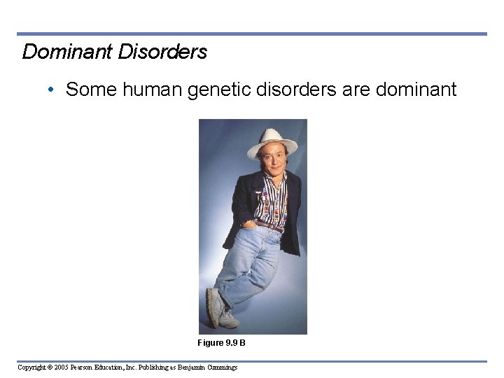 Dominant Disorders • Some human genetic disorders are dominant Figure 9. 9 B Copyright