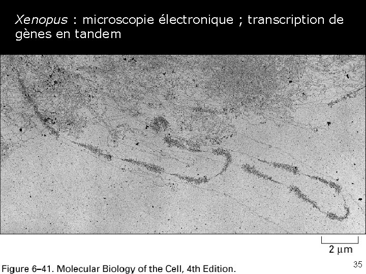Xenopus : microscopie électronique ; transcription de gènes en tandem Fig 6 -41 ME