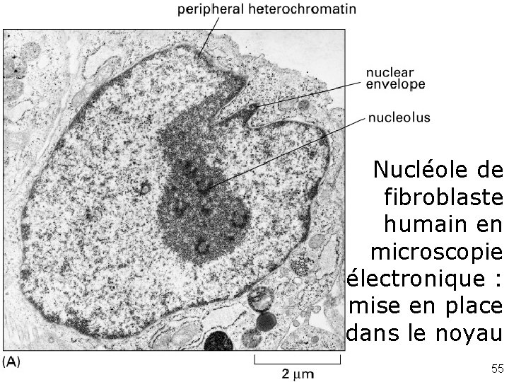 Fig 6 -44 ME Nucléole de fibroblaste humain en microscopie électronique : mise en