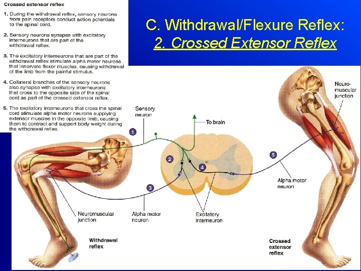 C. Withdrawal/Flexure Reflex: 2. Crossed Extensor Reflex AP 1 Chapter 12 26 