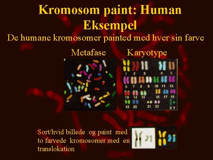 Kromosom paint: Human Eksempel De humane kromosomer painted med hver sin farve Metafase Karyotype