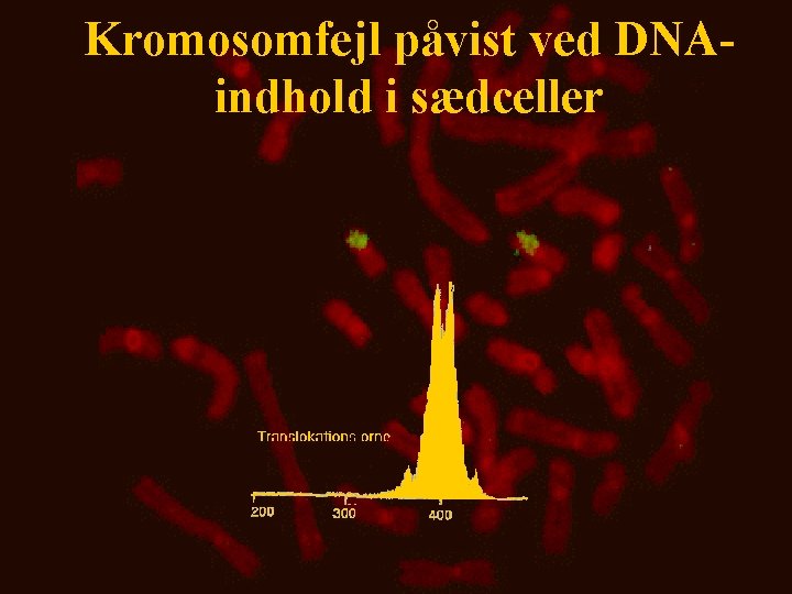 Kromosomfejl påvist ved DNAindhold i sædceller 