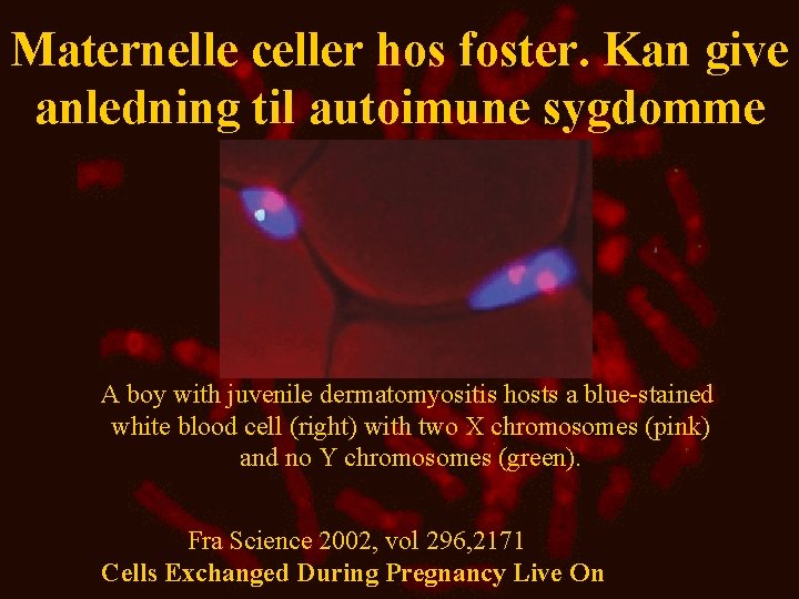 Maternelle celler hos foster. Kan give anledning til autoimune sygdomme A boy with juvenile