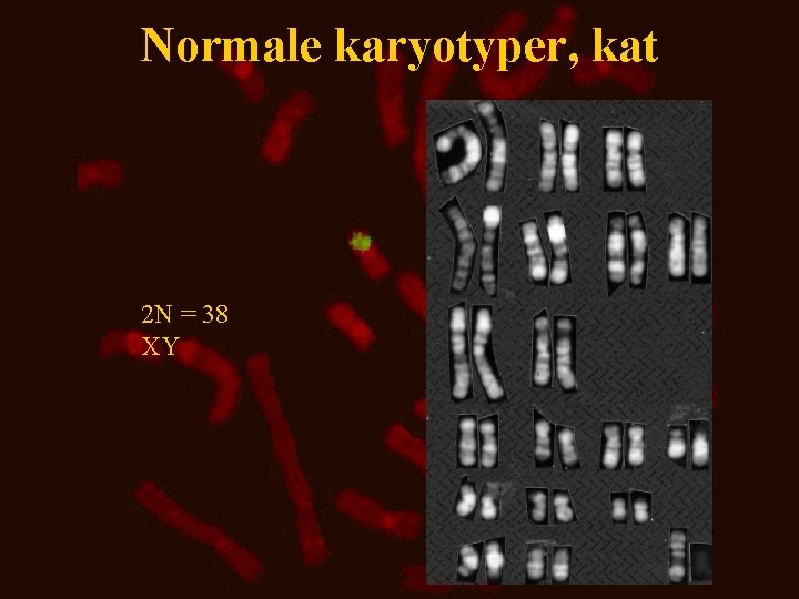 Normale karyotyper, kat 2 N = 38 XY 