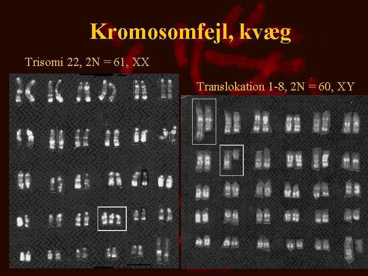 Kromosomfejl, kvæg Trisomi 22, 2 N = 61, XX Translokation 1 -8, 2 N