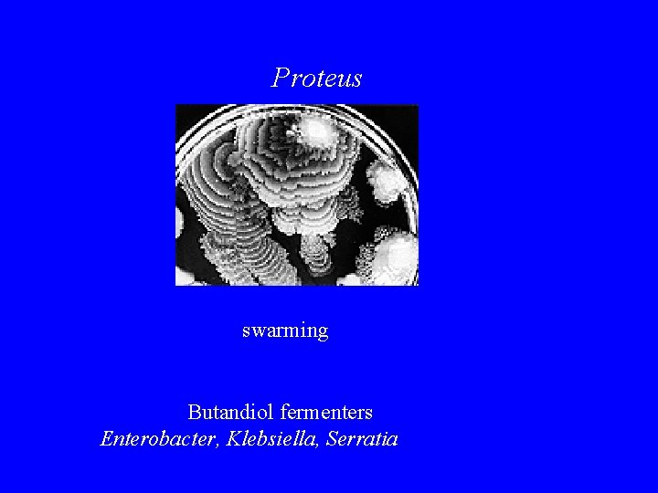 Proteus swarming Butandiol fermenters Enterobacter, Klebsiella, Serratia 