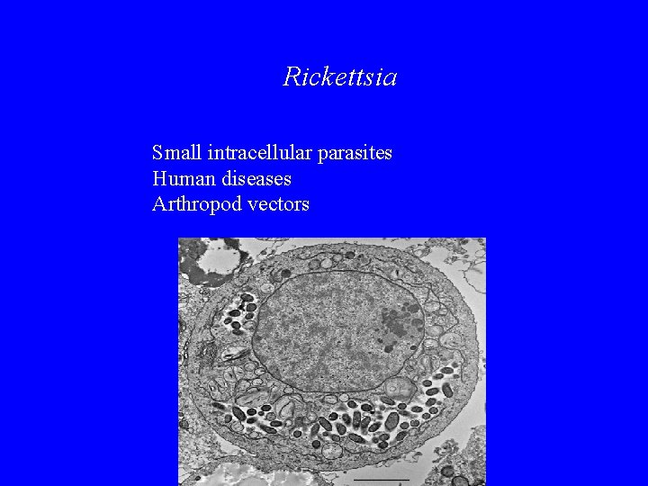 Rickettsia Small intracellular parasites Human diseases Arthropod vectors 