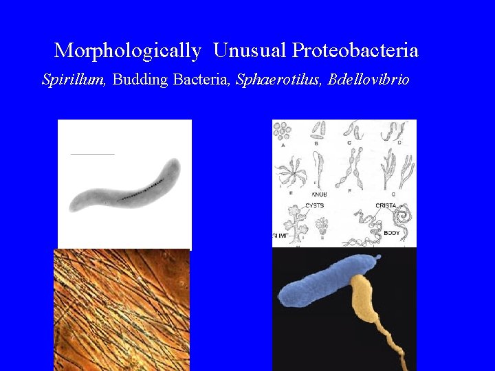 Morphologically Unusual Proteobacteria Spirillum, Budding Bacteria, Sphaerotilus, Bdellovibrio 