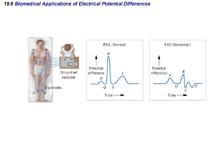 19. 6 Biomedical Applications of Electrical Potential Differences 19. 6 Biomedical Applications of Electrical Potential Differences
