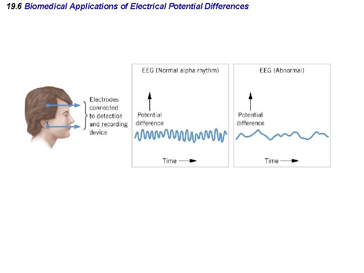 19. 6 Biomedical Applications of Electrical Potential Differences 19. 6 Biomedical Applications of Electrical Potential Differences