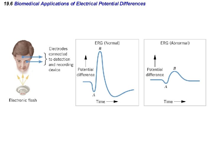 19. 6 Biomedical Applications of Electrical Potential Differences 19. 6 Biomedical Applications of Electrical Potential Differences
