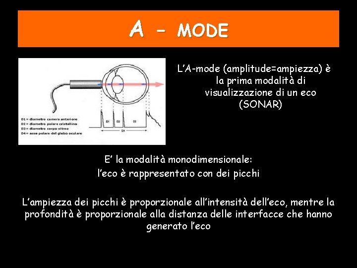 A - MODE L’A-mode (amplitude=ampiezza) è la prima modalità di visualizzazione di un eco