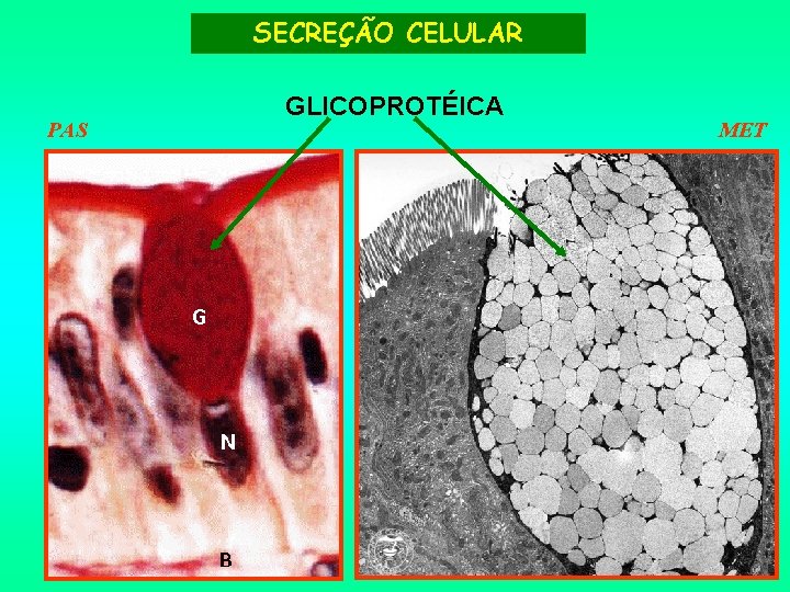 SECREÇÃO CELULAR PAS GLICOPROTÉICA MET 