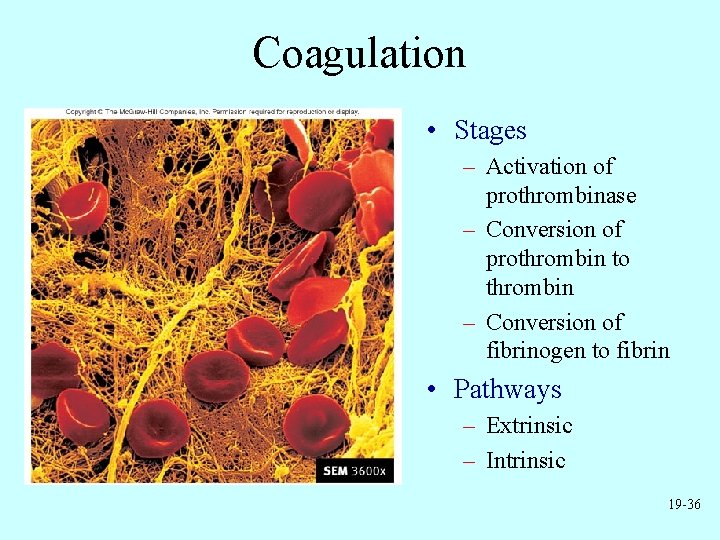 Coagulation • Stages – Activation of prothrombinase – Conversion of prothrombin to thrombin –