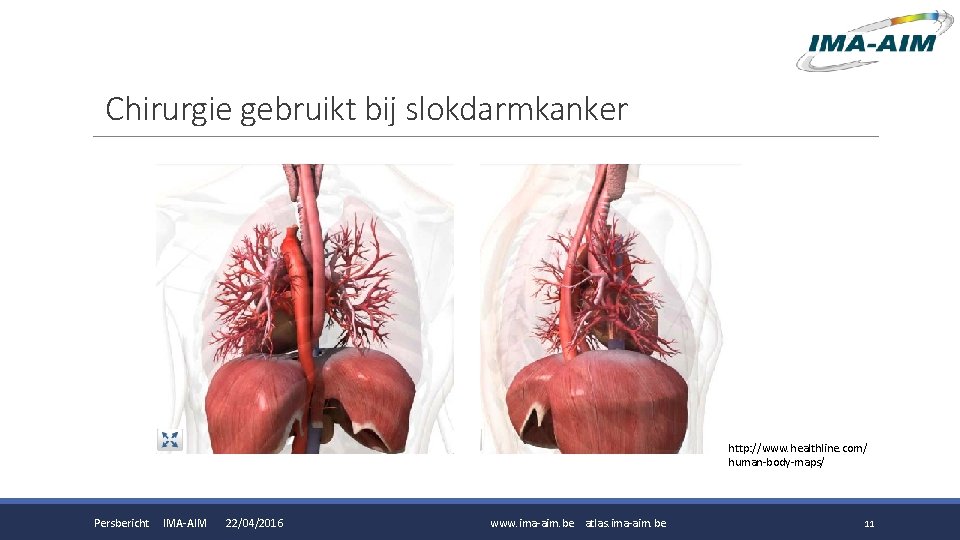 Chirurgie gebruikt bij slokdarmkanker http: //www. healthline. com/ human-body-maps/ Persbericht IMA-AIM 22/04/2016 www. ima-aim. Chirurgie gebruikt bij slokdarmkanker http: //www. healthline. com/ human-body-maps/ Persbericht IMA-AIM 22/04/2016 www. ima-aim.