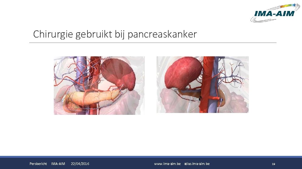 Chirurgie gebruikt bij pancreaskanker Persbericht IMA-AIM 22/04/2016 www. ima-aim. be atlas. ima-aim. be 19