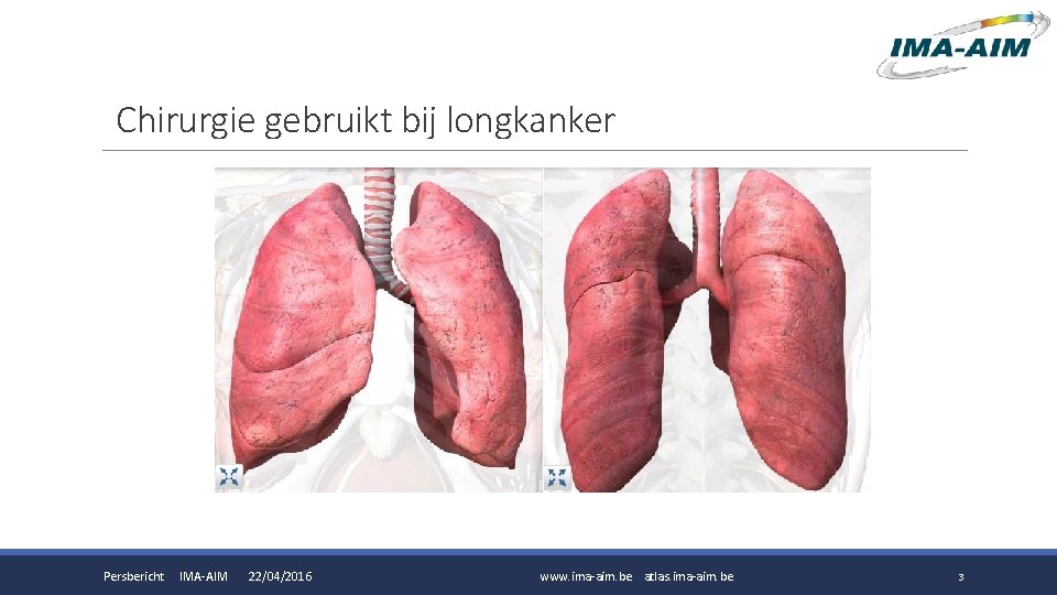 Chirurgie gebruikt bij longkanker Persbericht IMA-AIM 22/04/2016 www. ima-aim. be atlas. ima-aim. be 3