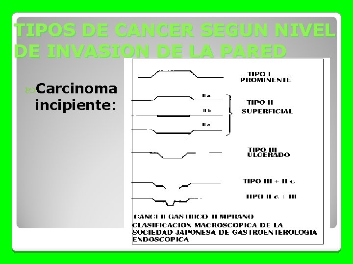 TIPOS DE CANCER SEGUN NIVEL DE INVASION DE LA PARED Carcinoma incipiente: 