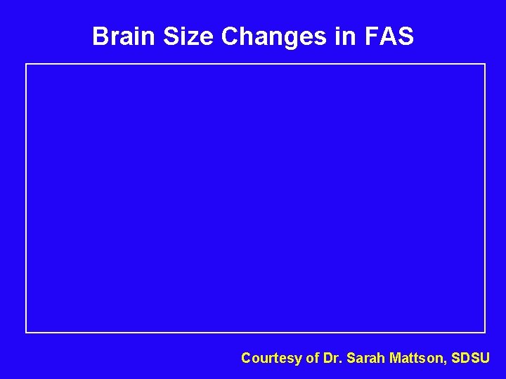 Brain Size Changes in FAS Courtesy of Dr. Sarah Mattson, SDSU 