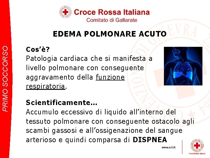 PRIMO SOCCORSO EDEMA POLMONARE ACUTO Cos’è? Patologia cardiaca che si manifesta a livello polmonare