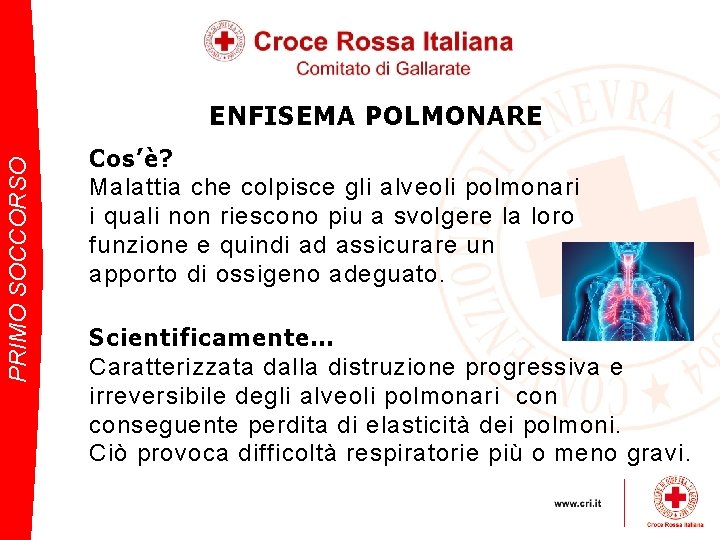 PRIMO SOCCORSO ENFISEMA POLMONARE Cos’è? Malattia che colpisce gli alveoli polmonari i quali non