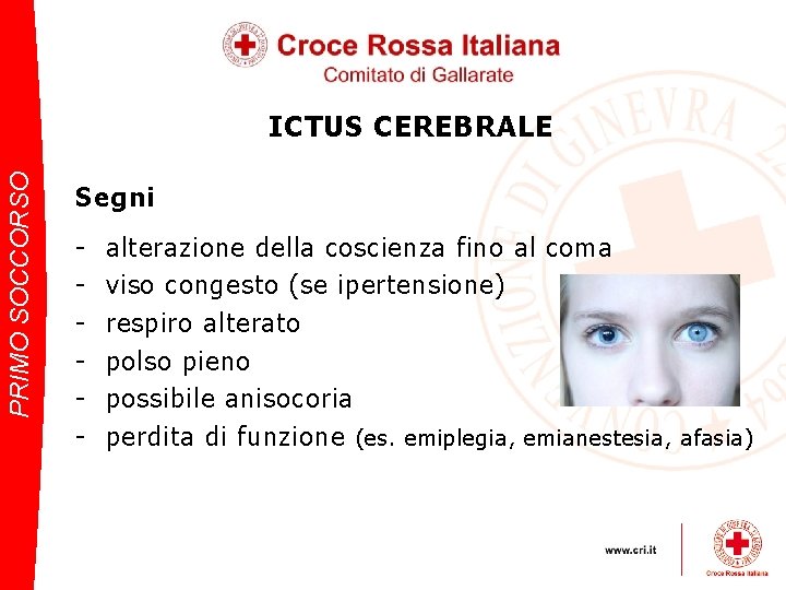 PRIMO SOCCORSO ICTUS CEREBRALE Segni - alterazione della coscienza fino al coma viso congesto