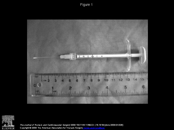 Figure 1 The Journal of Thoracic and Cardiovascular Surgery 2006 1321144 -1149 DOI: (10.