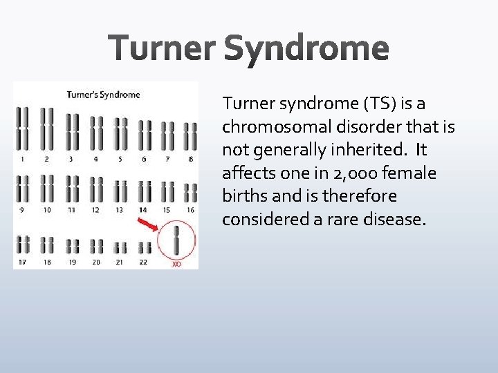 Turner syndrome (TS) is a chromosomal disorder that is not generally inherited. It affects