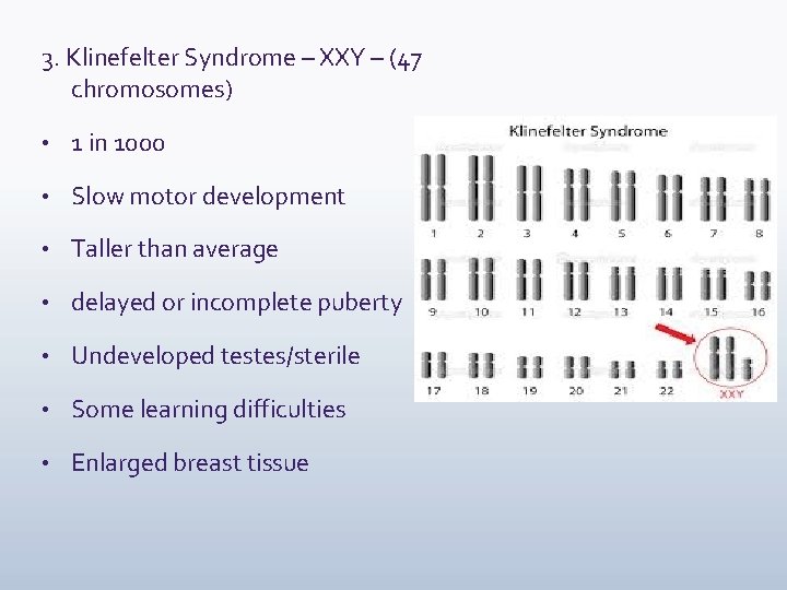 3. Klinefelter Syndrome – XXY – (47 chromosomes) • 1 in 1000 • Slow