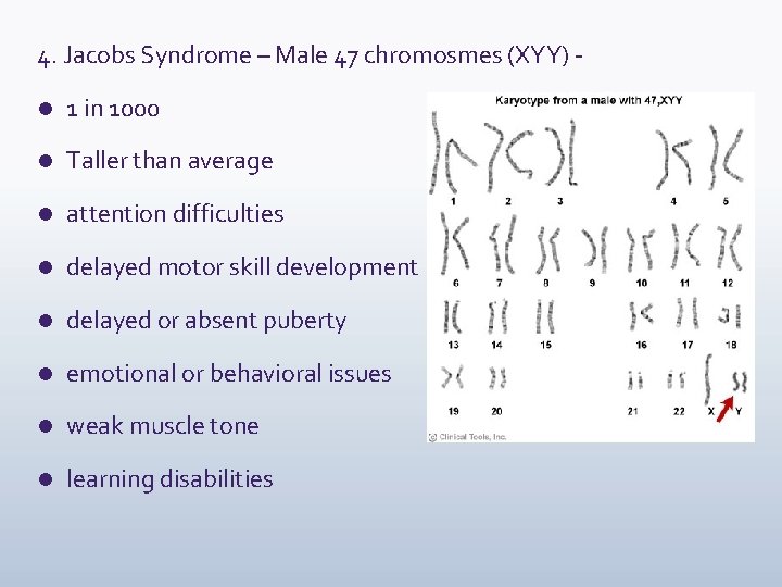 4. Jacobs Syndrome – Male 47 chromosmes (XYY) l 1 in 1000 l Taller