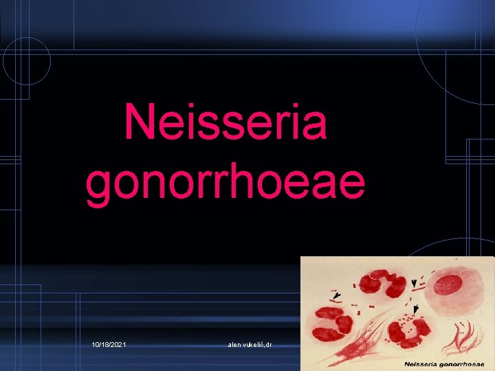 Neisseria gonorrhoeae 10/18/2021 alen vukelić, dr 1 