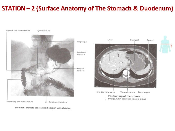 STATION – 2 (Surface Anatomy of The Stomach & Duodenum) 