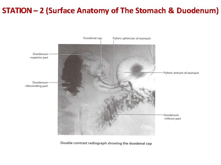 STATION – 2 (Surface Anatomy of The Stomach & Duodenum) 