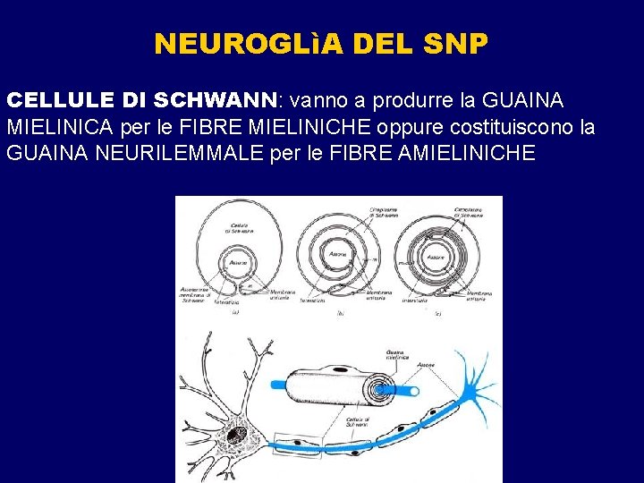 NEUROGLìA DEL SNP CELLULE DI SCHWANN: vanno a produrre la GUAINA MIELINICA per le NEUROGLìA DEL SNP CELLULE DI SCHWANN: vanno a produrre la GUAINA MIELINICA per le