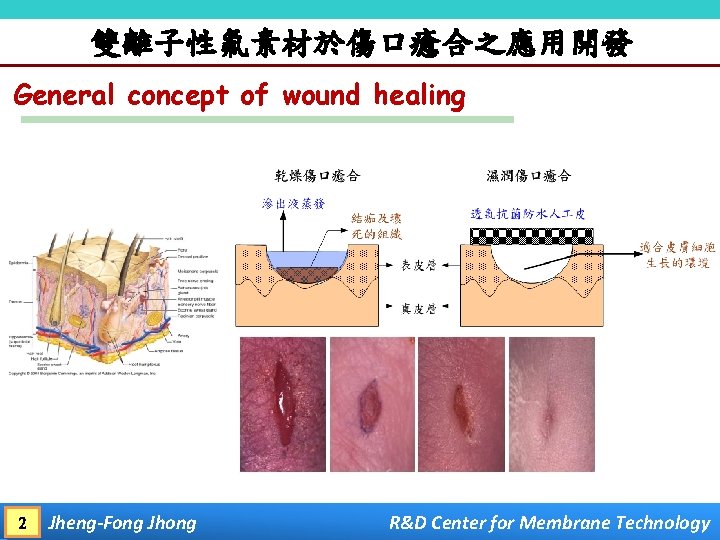 雙離子性氟素材於傷口癒合之應用開發 General concept of wound healing 2 Jheng-Fong Jhong R&D Center for Membrane Technology