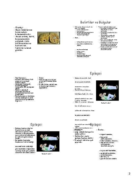 Belirtiler ve Bulgular • Etyoloji: • Beyin tümörlerinin kesin nedeni bilinmemektedir. • Ancak arıtma,