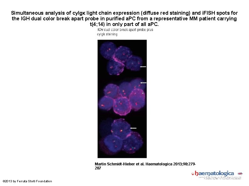 Simultaneous analysis of cy. Igκ light chain expression (diffuse red staining) and i. FISH