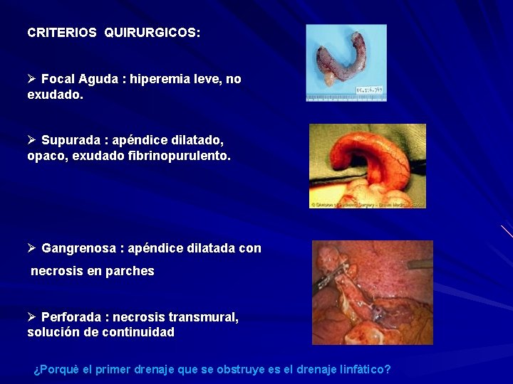 CRITERIOS QUIRURGICOS: Ø Focal Aguda : hiperemia leve, no exudado. Ø Supurada : apéndice