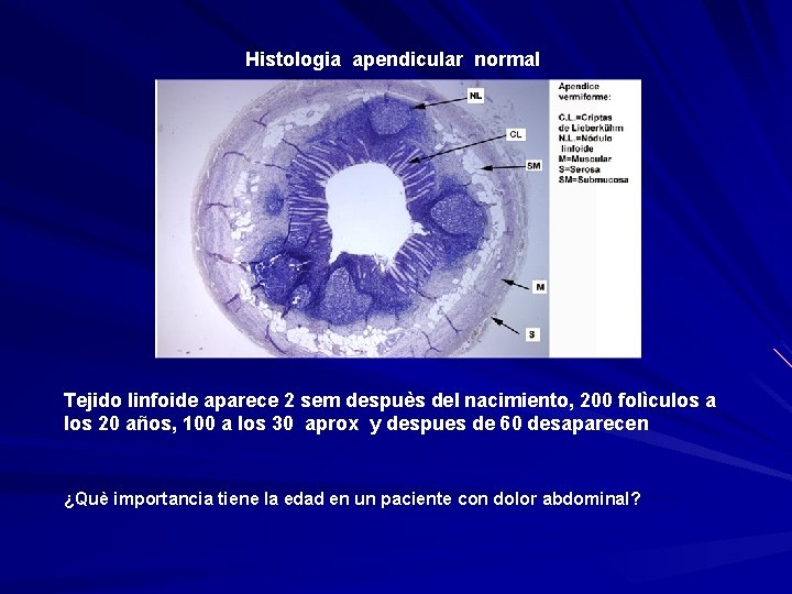 Histologia apendicular normal Tejido linfoide aparece 2 sem despuès del nacimiento, 200 folìculos a