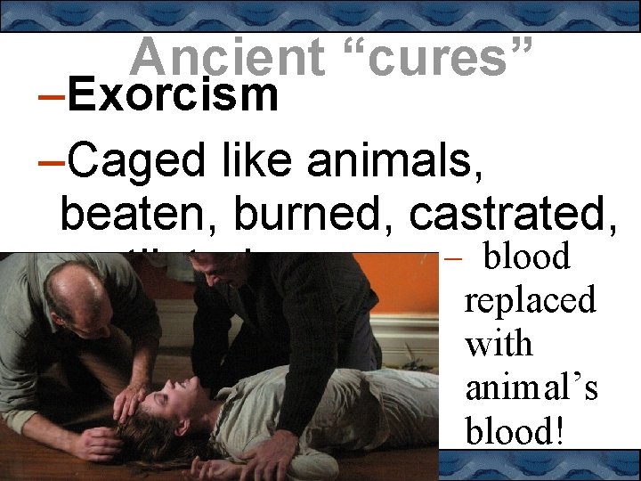 Ancient “cures” –Exorcism –Caged like animals, beaten, burned, castrated, – blood mutilated replaced with