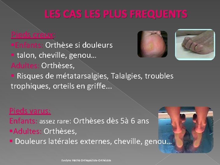 LES CAS LES PLUS FREQUENTS Pieds creux: §Enfants: Orthèse si douleurs § talon, cheville,