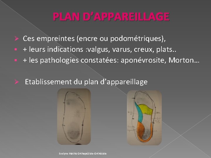 PLAN D’APPAREILLAGE Ces empreintes (encre ou podométriques), § + leurs indications : valgus, varus,